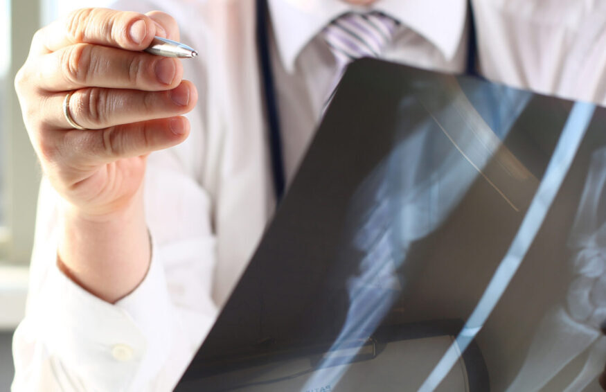 Male doctor hold in arm silver pen and look at xray